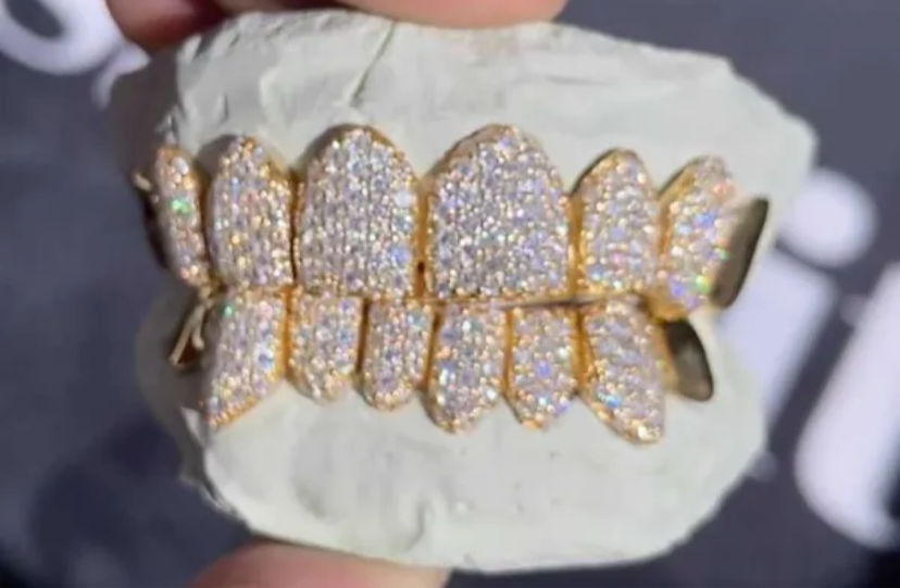 VVS Moissanite 8 Piece Grills custom set “Pass Diamond Test”