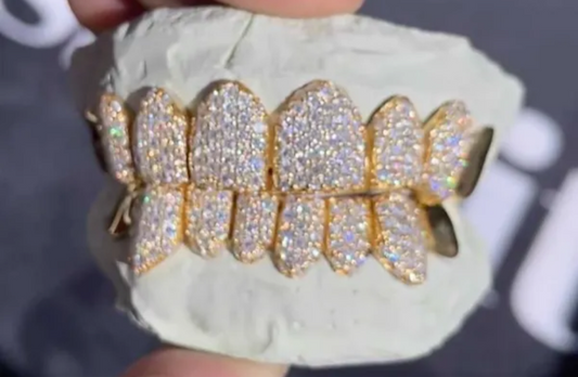 VVS Moissanite 8 Piece Grills custom set “Pass Diamond Test”