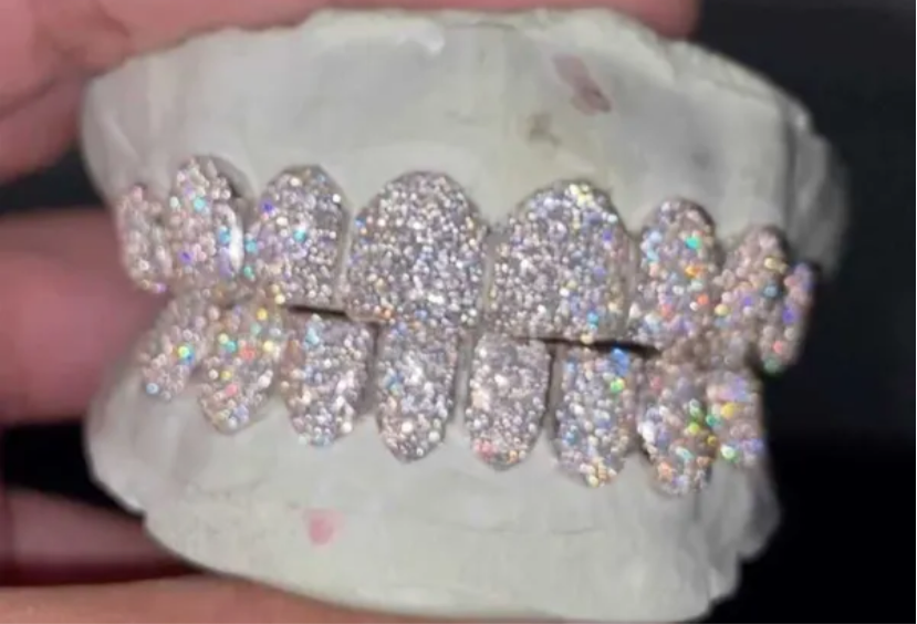 VVS Moissanite 8 Piece Grills custom set “Pass Diamond Test”