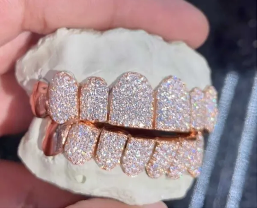 VVS Moissanite 8 Piece Grills custom set “Pass Diamond Test”